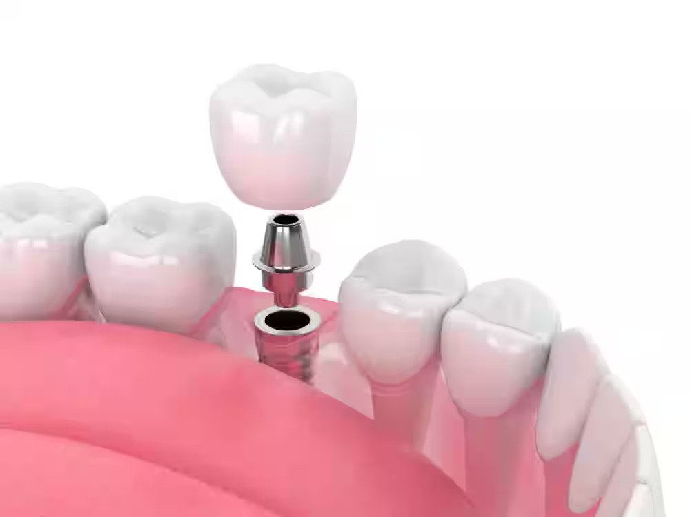 My Smile Luxe Dental Lounge